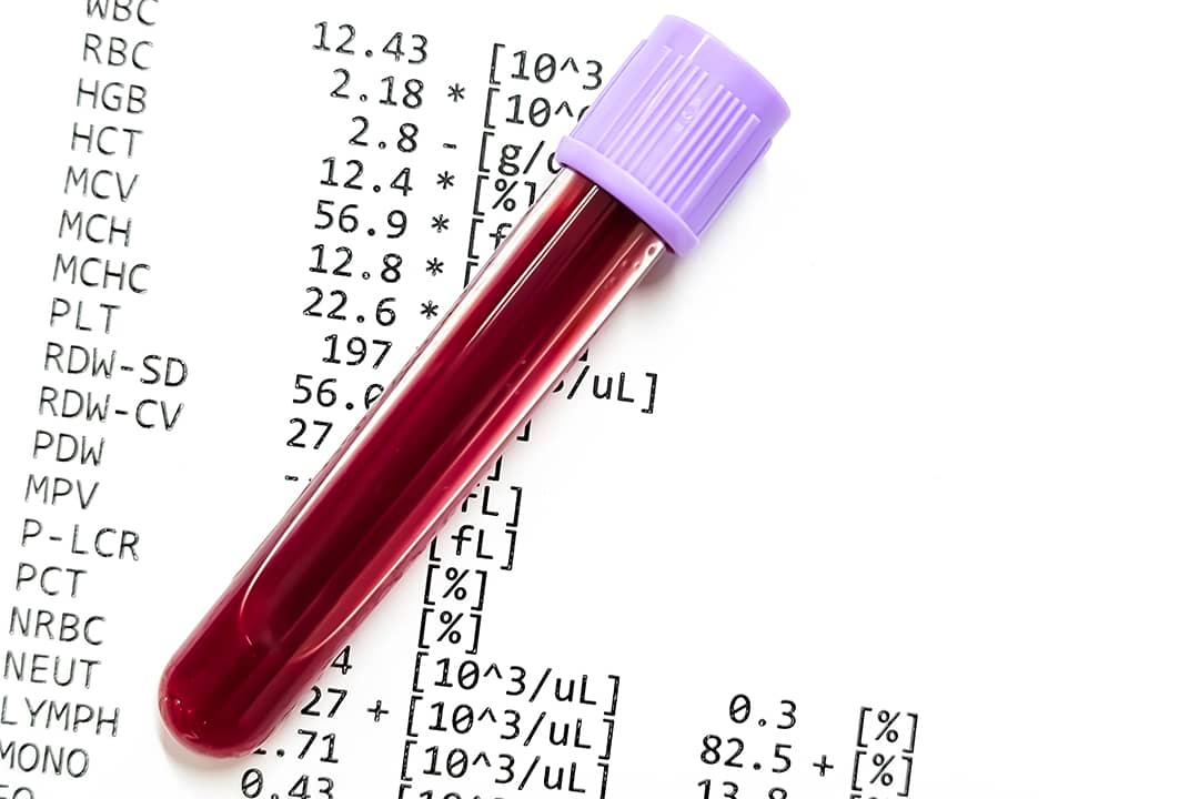 A blood sample in a collection tube and a complete blood count (CBC) report underneath.